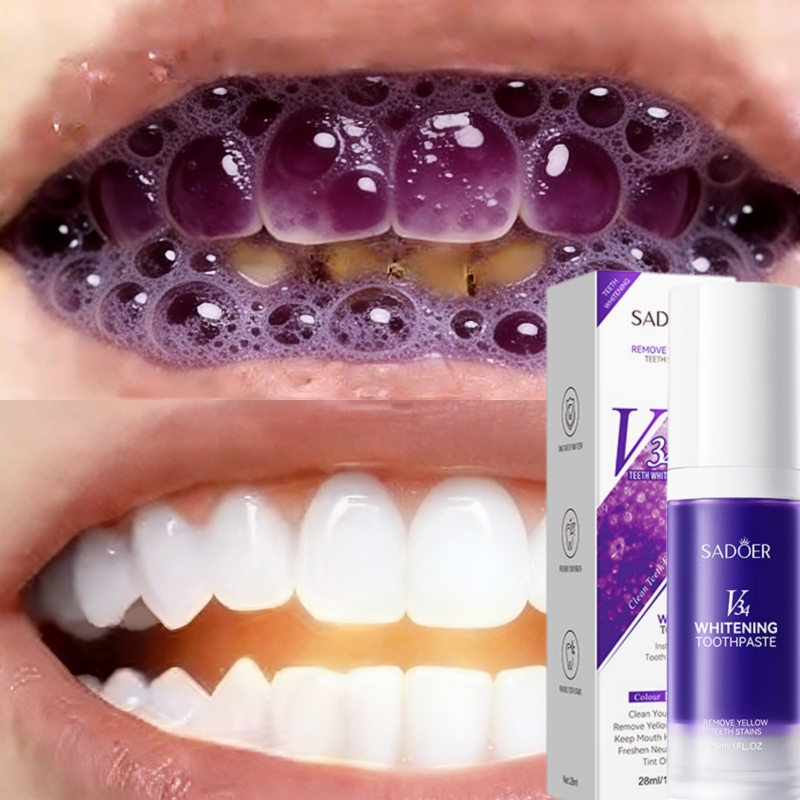 Teeth Whitening Effective - Dentifricio Sbiancante Bestseller 2026: Rimuove Efficacemente