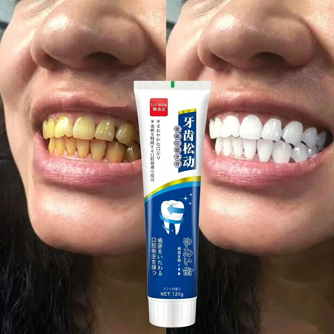 Teeth Whitening Japanese - Dentifricio Giapponese Importato per Denti Doloranti,