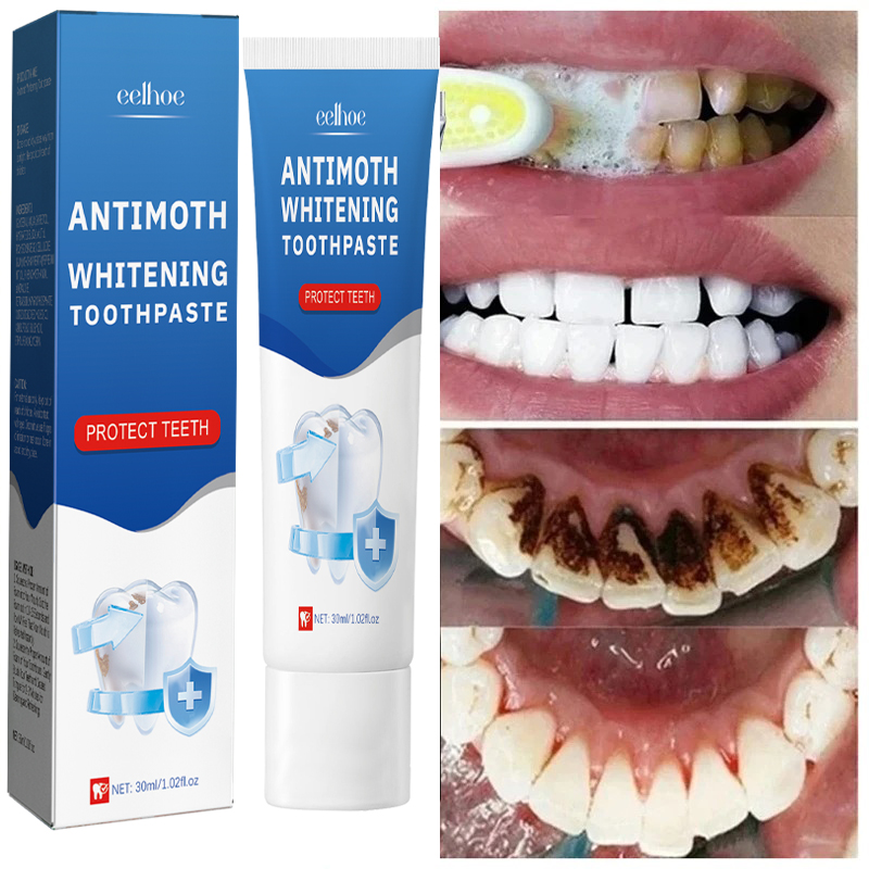 Teeth Whitening Fast - Rimozione rapida delle macchie di fumo
