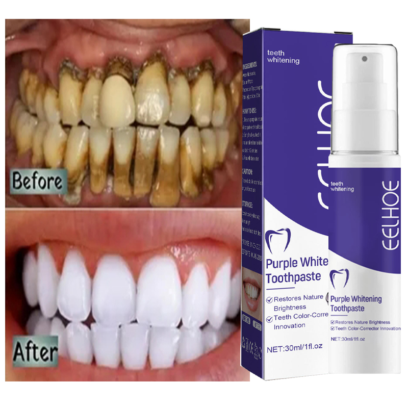 Teeth Whitening Korea - 1 pz pulizia dei denti sbiancante