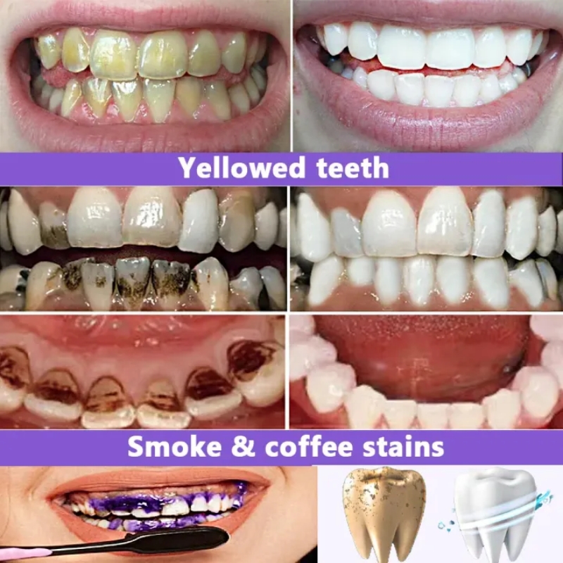 Dentifricio Sbiancante Bestsel - Teeth Whitening Effective recensione e prezzo