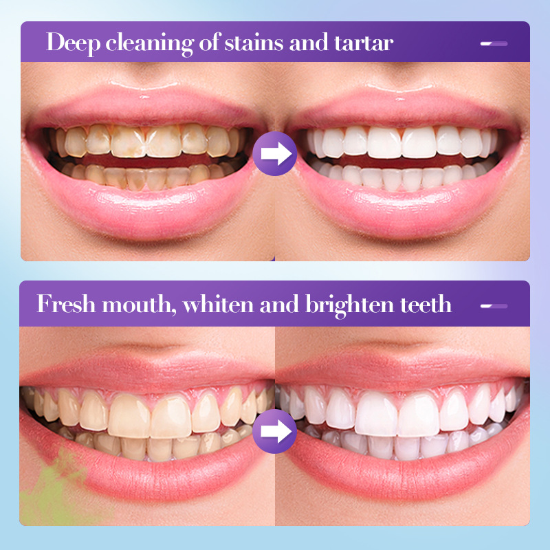 Dentifricio Sbiancante Bestsel - Teeth Whitening Effective recensione e prezzo