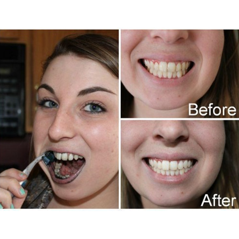 Denti di carbone di bambù dent - Teeth Whitening Charcoal Powder recensione e prezzo