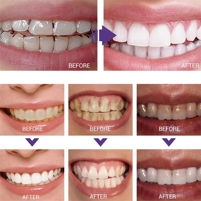 Dentifricio Sbiancante per la  - Teeth Whitening Korea recensione e prezzo