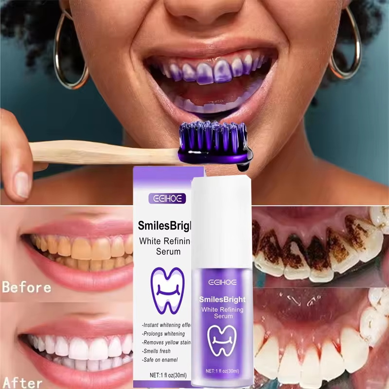 Dentifricio Sbiancante per la  - Teeth Whitening Korea recensione e prezzo