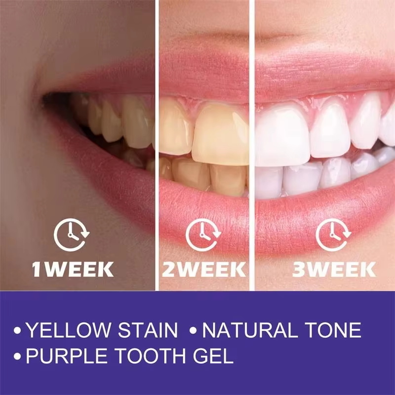 Dentifricio Sbiancante per la  - Teeth Whitening Korea recensione e prezzo