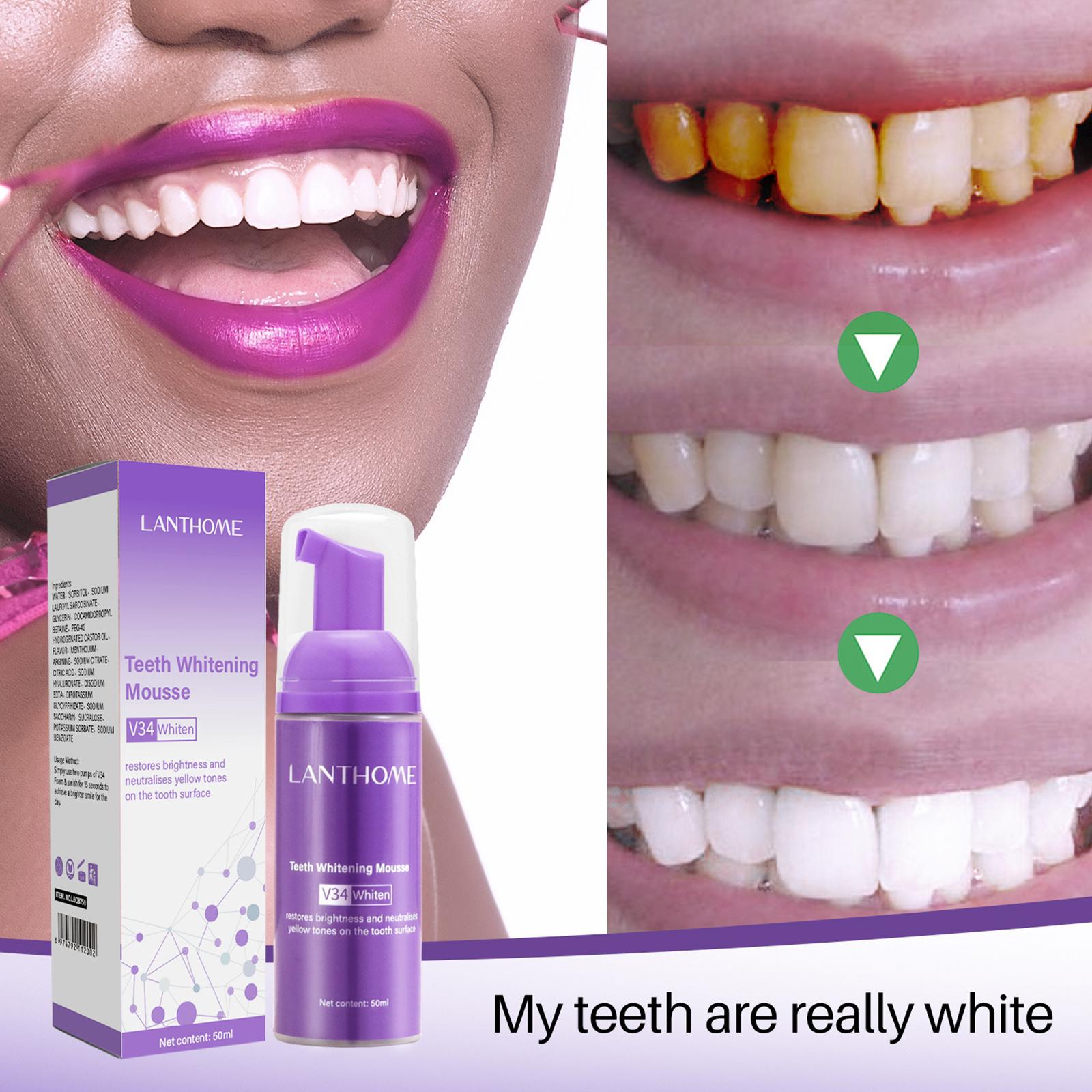 V34 Mousse Dentifricio per la  - Teeth Whitening Effective recensione e prezzo