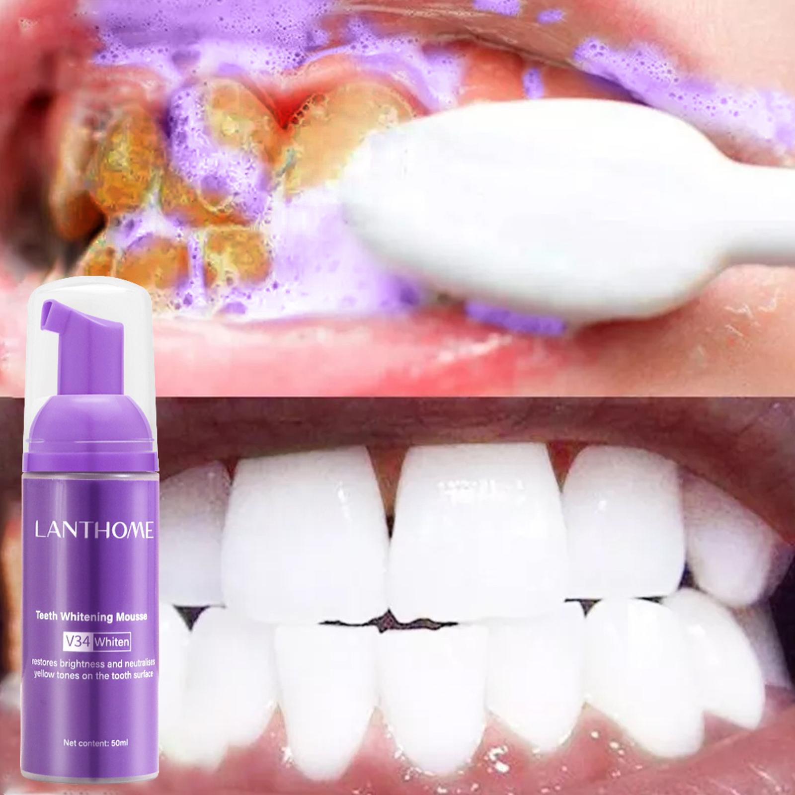 V34 Mousse Dentifricio per la  - Teeth Whitening Effective recensione e prezzo