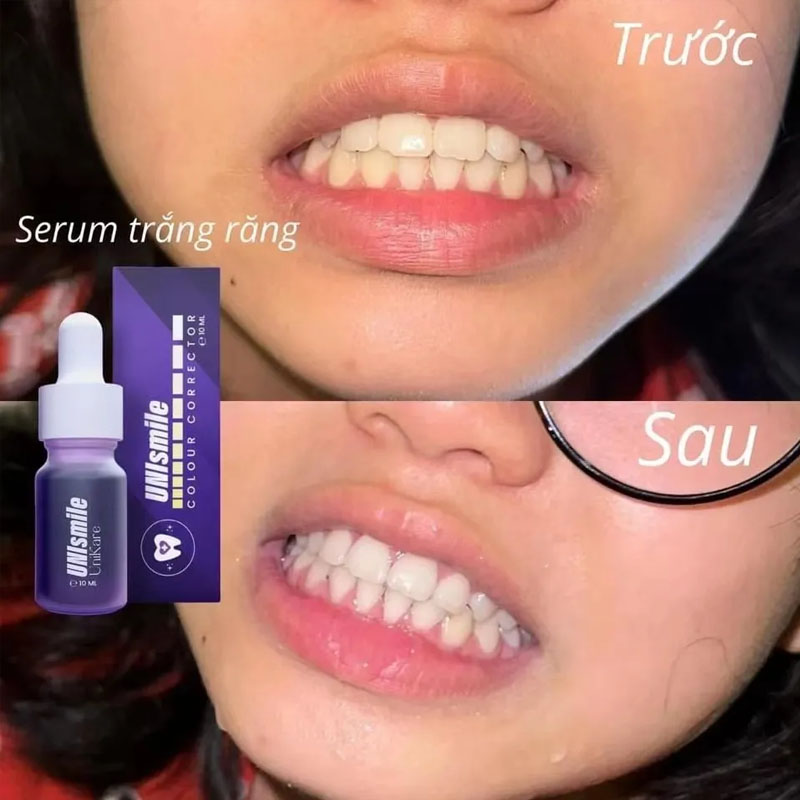 Unismile Essenza per sbiancame - Teeth Whitening Effective recensione e prezzo