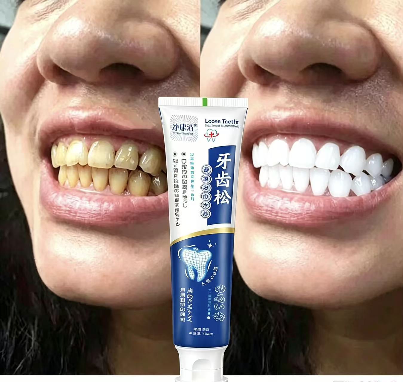 Gocce Sbiancanti per Denti, Ri - Teeth Whitening Fast recensione e prezzo