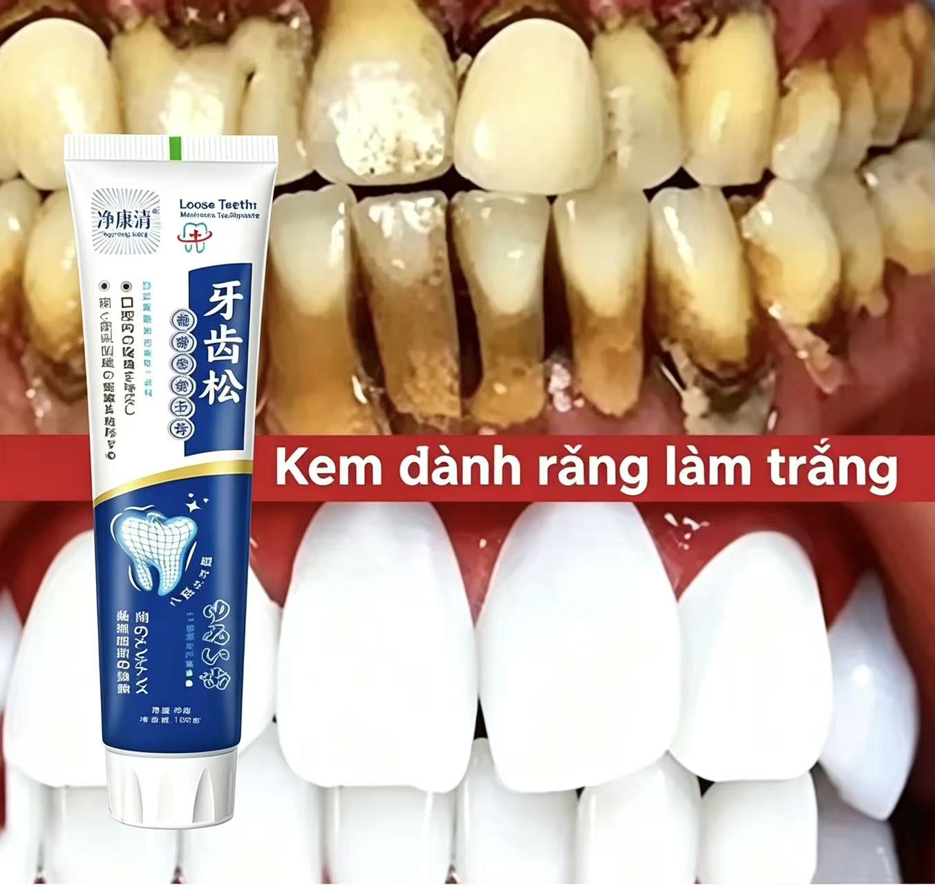 Gocce Sbiancanti per Denti, Ri - Teeth Whitening Fast recensione e prezzo