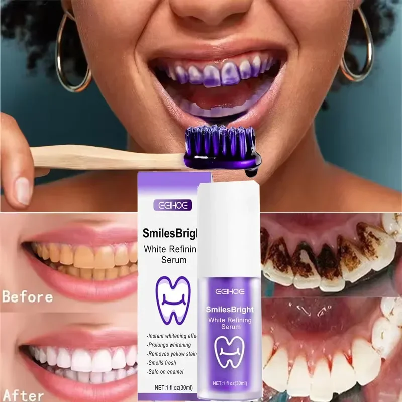 Dentifricio sbiancante per la  - Teeth Whitening Korea recensione e prezzo