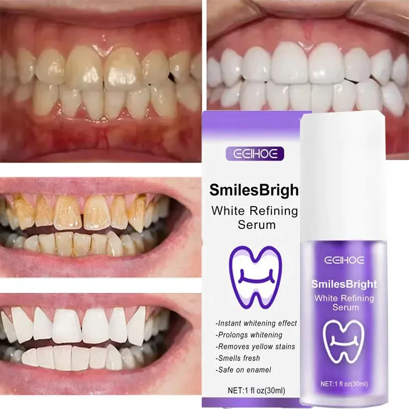 Dentifricio sbiancante per la  - Teeth Whitening Korea recensione e prezzo