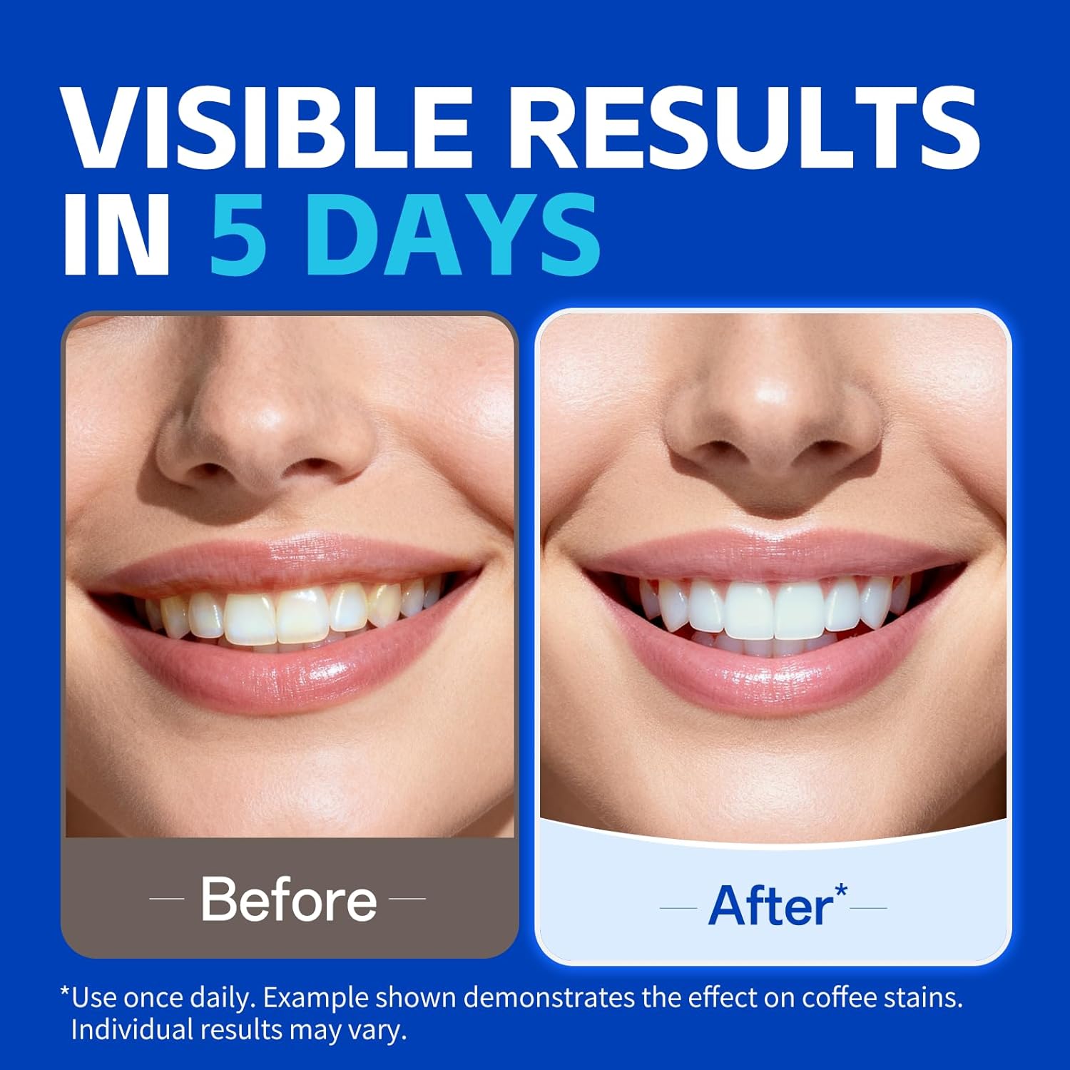 1/7 Paia di Strisce Sbiancanti - Teeth Whitening Strips Crest recensione e prezzo
