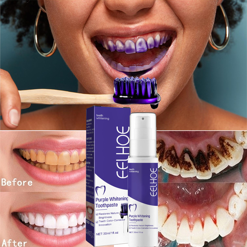 1 pz pulizia dei denti sbianca - Teeth Whitening Korea recensione e prezzo