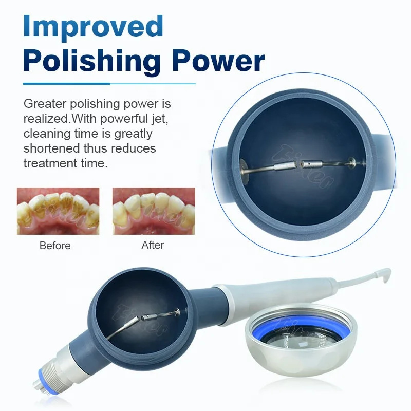 Prophy Mate Pulizia dei denti  - Teeth Whitening Fast recensione e prezzo