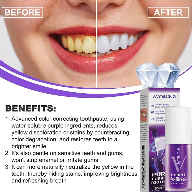 Dentifricio Sbiancante per la  - Teeth Whitening Korea recensione e prezzo