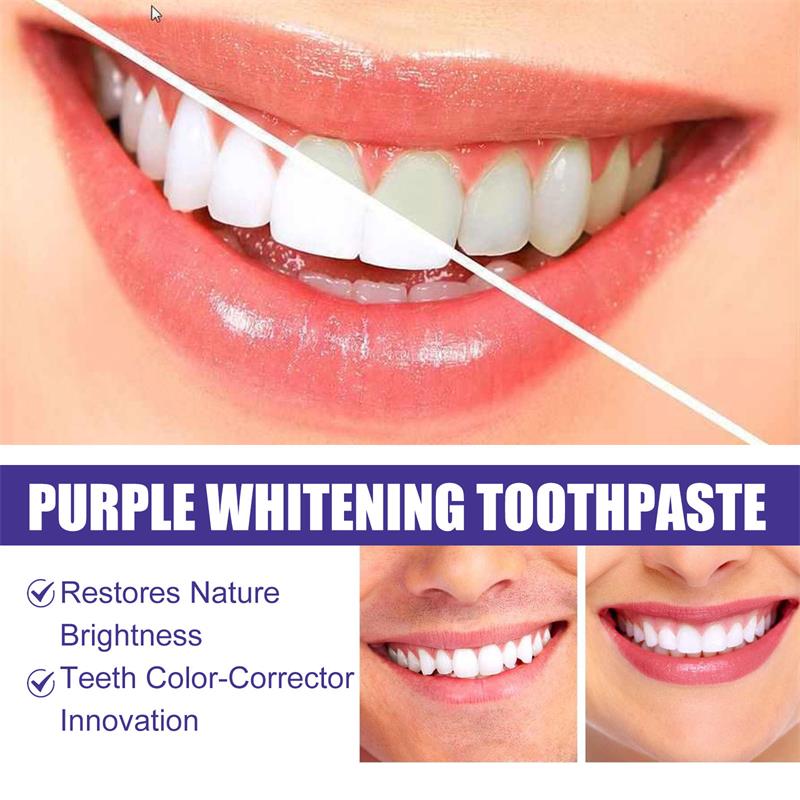 Dentifricio Sbiancante per la  - Teeth Whitening Korea recensione e prezzo