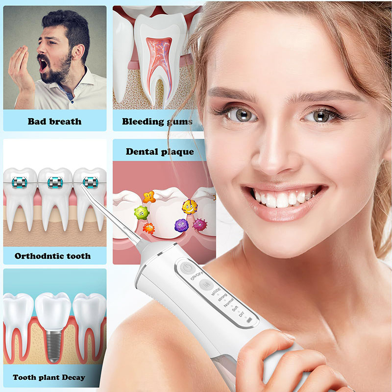 Professionale Flossing portati - Water Flosser Cordless recensione e prezzo